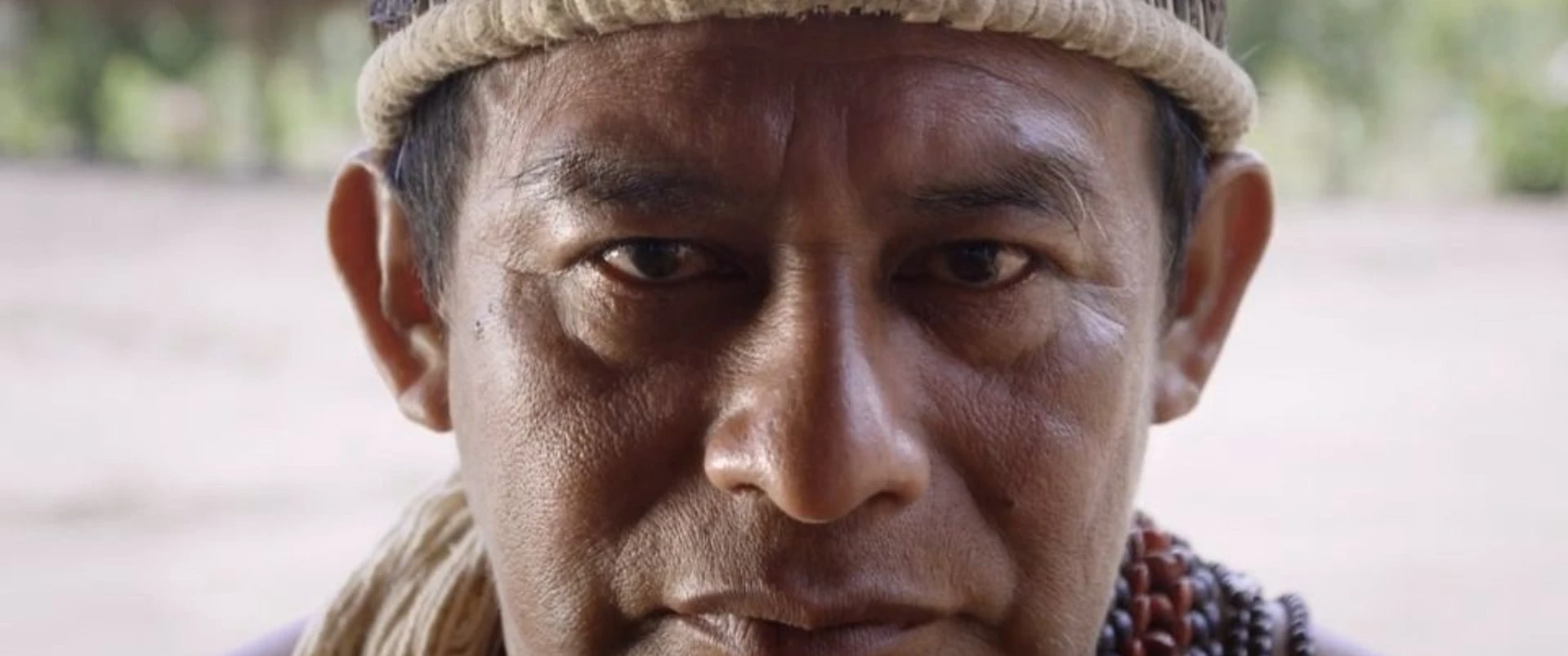 Amazônia, a Nova Minamata?  